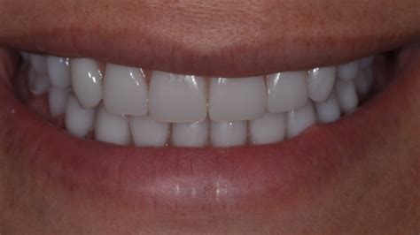 best denture dentist near me.